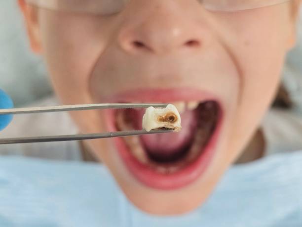 Best Emergency Treatment for Oral Infections in Sharon Center, OH
